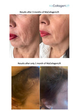 Load image into Gallery viewer, MyCollagenLift